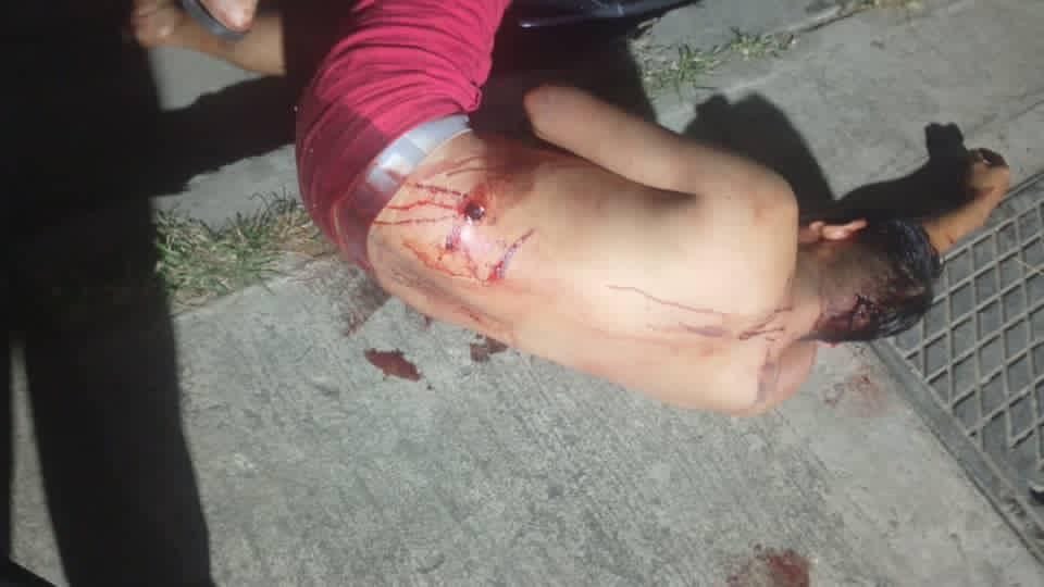 Delincuentes hieren a vecino y roban motocicleta en urbanismo de Palo Negro