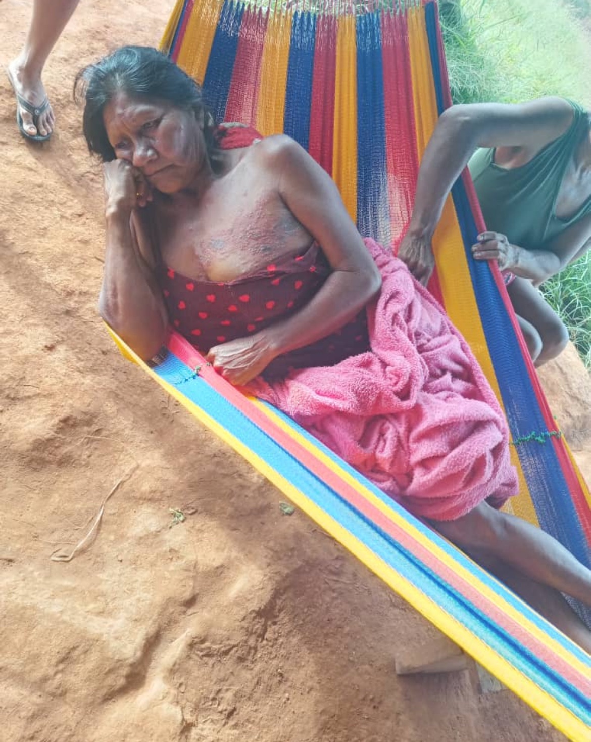 ? Grave crisis sanitaria afecta a más de 120 indígenas sánema del Alto Caura, estado Bolívar