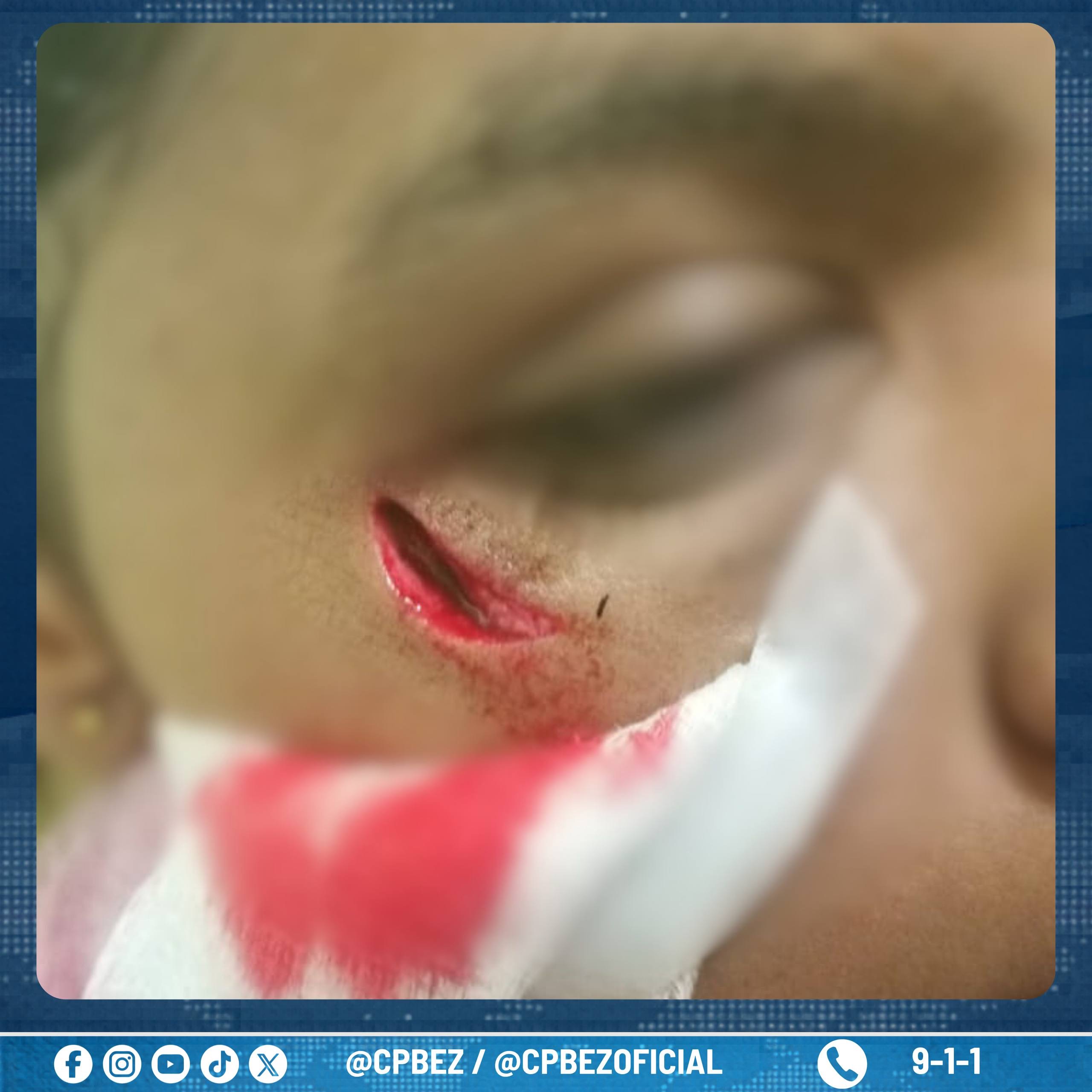 Por un plato de arroz! Hombre golpeó brutalmente a su sobrina de 16 años en Machiques